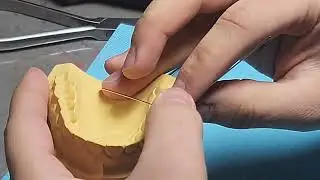 دكتور حسنين Adams clasp