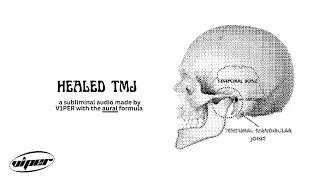 h34led tmj.