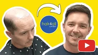 Instant Hair Makeover: Unveiling the Jaw-Dropping Results of Hair Systems!
