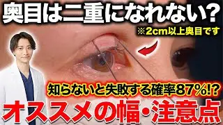 受ける前に見て！奥目な人が二重整形受ける際のオススメの幅と注意点