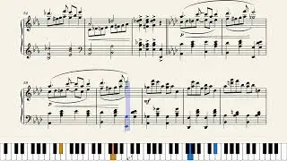 Nervous Fingers by J. Paques (1930)