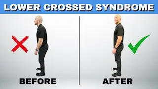 What are 5 Main Symptoms of Lower Crossed Syndrome and a Clear Fix!