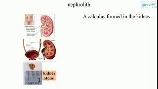 nephrolith