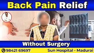 Severe Back Pain Relief | Without Surgery & Medicines | Sun Physio Hospital .