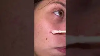 Say Goodbye to Pimples! #fok #dryinglotion #pimpleremover #pimplepatch