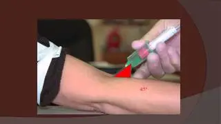 What is the proper angle-of-insertion for venipunctures?