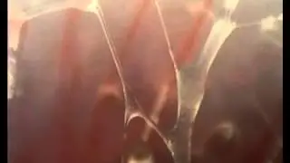 Dr Jean Claude Guimberteau MD about fascia. Tissue that connects, or disconnects.