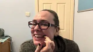 The final stretch! Invisalign finished, implant on and whitening treatment. 2 year update.