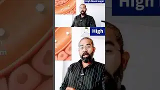 Weight loss in diabetes. Diabetes awareness. #diabetes #weightloss #diabetessymptoms #vdprashant