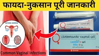 Candid v gel uses in hindi | candid v gel kaise lagaya jata hai | candid v gel reviews