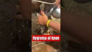 Hygroma of knee in cow l dr Umar Khan