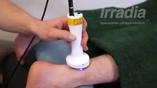 IRRADIA - David S&ouml;derstr&ouml;m utf&ouml;r laserbehandling p&aring; h&auml;lsena