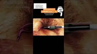 Estamos respondiendo tus dudas en Instagram YouTube Facebook |#obstruc