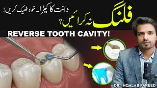 Top Dentist Shares 5 Secrets to REVERSE Dental Caries Naturally