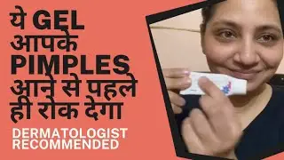 Best Gel to Cure Pimples & Acne | Effective Gel to Cure Acne | Hritu Saklani