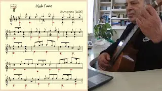 IrishTune 🎶 Anonymous (1600)