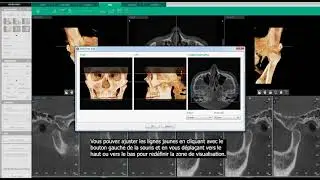 Vatech [Ez3D-i] - ATM Onglet 01 : Param&eacute;trage de l'onglet ATM