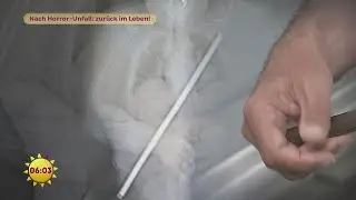 Eisenstange quer durch den K&ouml;rper - nach Horror-Unfall zur&uuml;ck im Leben! | SAT.1 Fr&uuml;hst&uuml;cksfernsehen