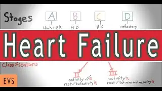 Heart Failure Classification & Monitoring