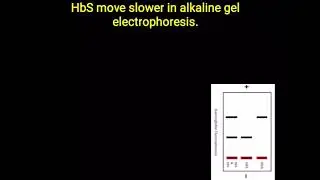 HbS - Electrophoresis