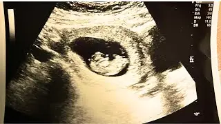 WE'RE HAVING A BABY!!!