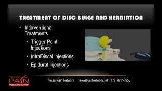 Disc Bulge & Disc Herniation Explained by a Dallas Pain Clinic (844) TEX-PAIN