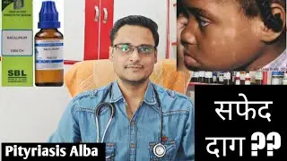 Pityriasis alba homeopathic treatment ?? explain|| चेहरे पर सफेद दाग ??