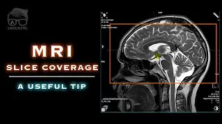 MRI &ndash; SLICE COVERAGE &ndash; A USEFUL TIP