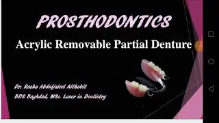 acrylic removable partial dentures | Lec 11 | rpd