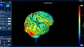 tDCS Soterix HD Explore Application Video  2 Anodes 2 Cathodes Montage