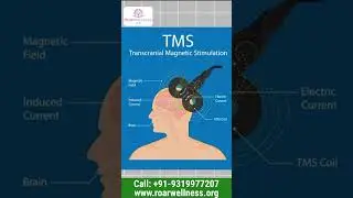 Depression & Anxiety Treatment Beyond Medicine | TMS Brain Stimulation Explained by Dr Manish Sarkar