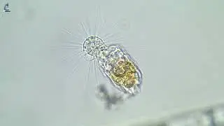 Солнечник Актинофрис пытается съесть коловратку. Heliozoa Actinophrys is trying to eat rotifer.