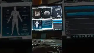 LIVE MRCP Planing on United imaging || MRI & CT TECHNOLOGIST #Radiologyvideo