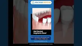 Missing Teeth? Restore Your Smile with Dental Implants | Archak Dental Clinic in Bangalore #dentist
