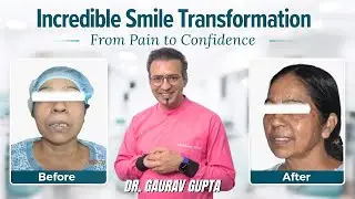 Full Mouth Dental Implant Transformation | Before & After Smile Makeover | Restore Your Teeth