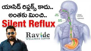 యాసిడ్ రిఫ్లక్స్ కాదు అంతకు మించి | Silent Reflux | LPR | How To Fix LPR | Dr Ravi Vide