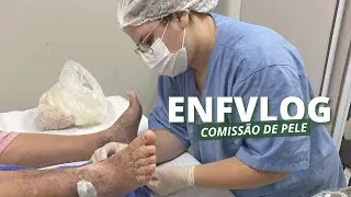 #ENFVLOG INTERNATO - COMISSÃO DE PELE