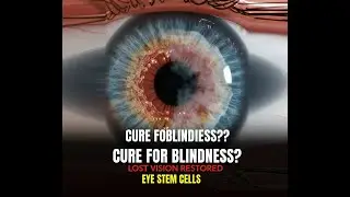 Bioengineered Stem Cell Implants for Restoring Vision | InventionNetwork