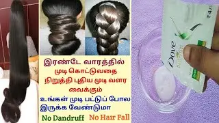 Hair Fall Solution In Tamil / Fast Hair Growth In Tamil / Hair Loss Treatment / At Home / Dandruff