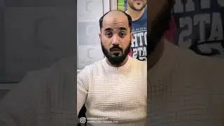 hair patch short video | hair patch look | Anas sheikh video | call us 9650914665