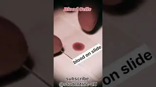 Blood under microscope 🔬#shorts #science #experiment #knowledge #study #students