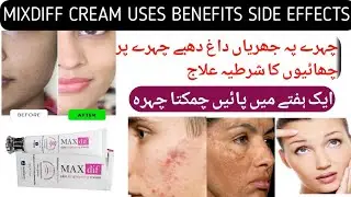 Maxdif Cream : Dr. Review, Benefits, Side Effects, Price, Ingredients & How to Use