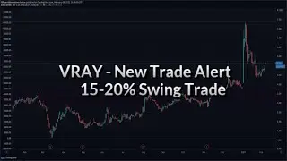 Top Stocks to Buy or Sell Now? | VRAY Viewray Inc. | Free Trade Alert | 15-20% Swing Trade