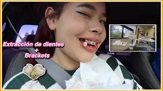 ME QUITAN 4 DIENTES Y ME PONEN BRACKETS *vlog*!