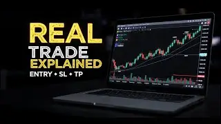 Real Trade Explained 📉📈 | Setup, Entry, SL & TP (Hindi)