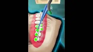 Correct bite alignment (like overbite, underbite, crossbite)Help teeth  the correct position faster