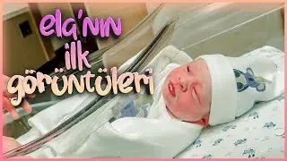 ELA'NIN DOĞUMU (İLK KEZ YÜZÜNÜ GÖRECEKSİNİZ)