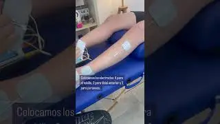 Tratamiento de esguince de tobillo con electroestimulaci&oacute;n #fisioterapia #fisioterapeuta