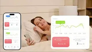 iBaby i20 Smart Baby Monitor with Breathing Monitor | 2026 NAPPA Award Winner