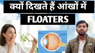Eye Floaters Explained​Why Do I See Spots Floating in My Vision? #EyeFloaters #VisionHealth #EyeCare